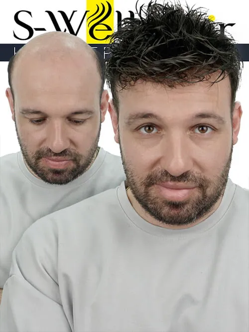 hair systems