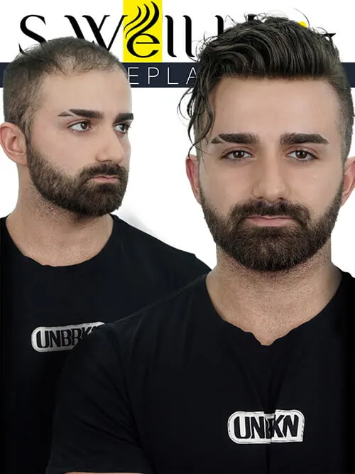 gerçek saç peruk
