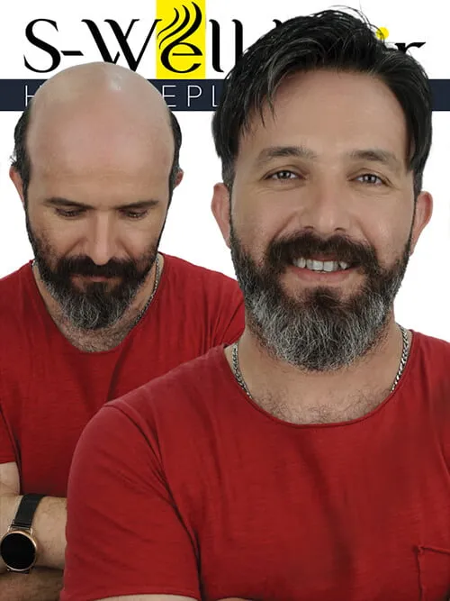 saç peruk