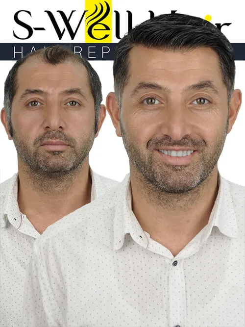 Haarersatz