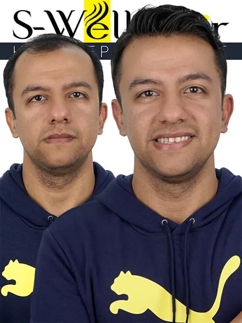 erkek peruk modelleri