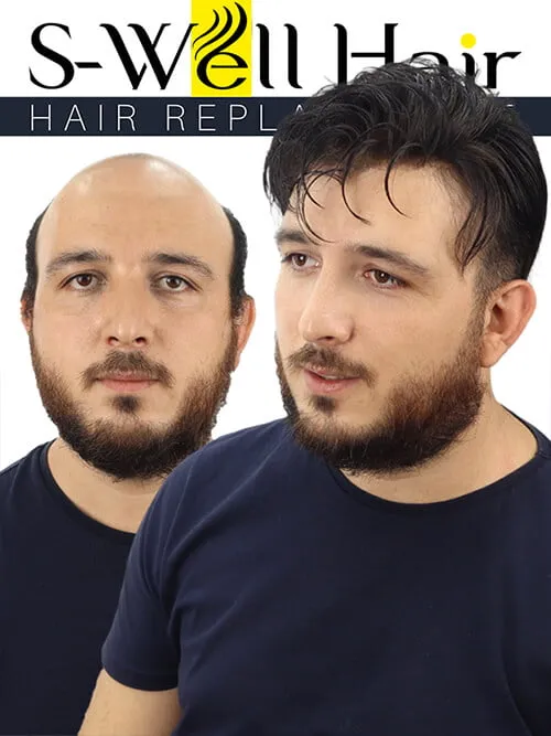 su geçirgen protez saç