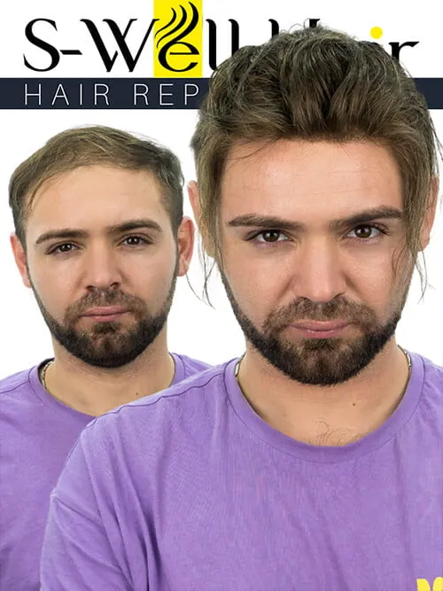 man toupee