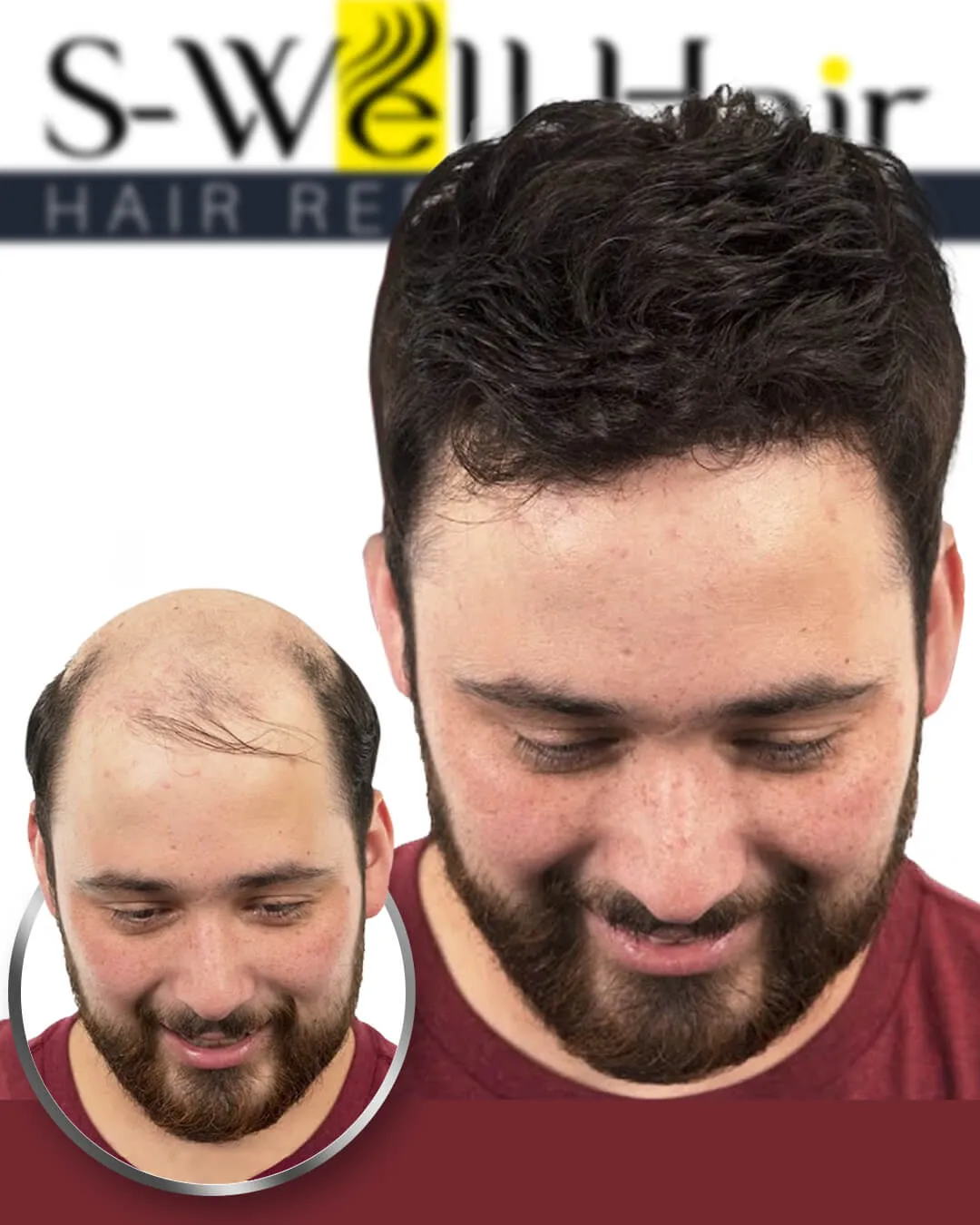 protez saç fotoğrafları