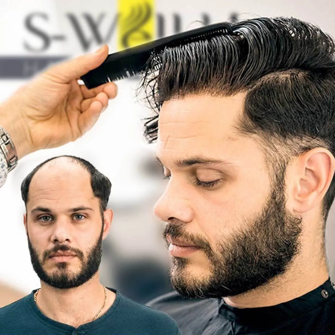 protez saç fotoğrafları
