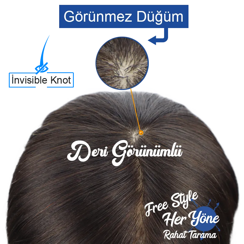 belli olmayan tepelik