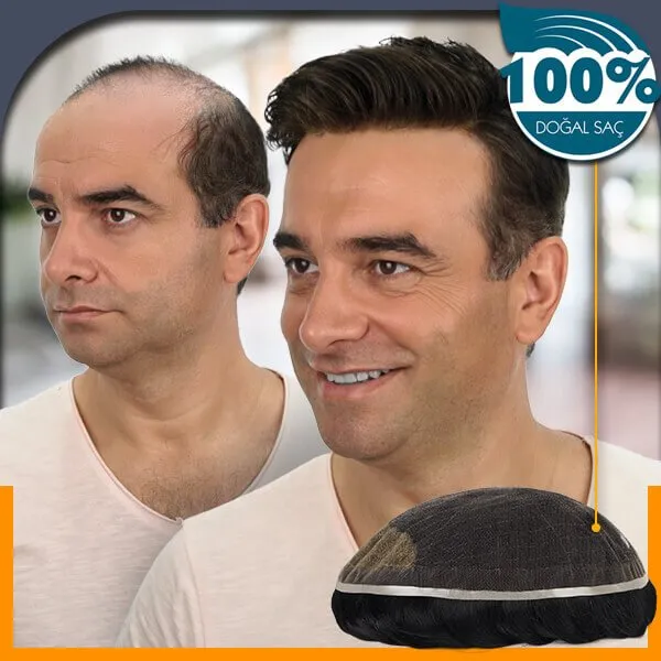 %100 doğal protez saç