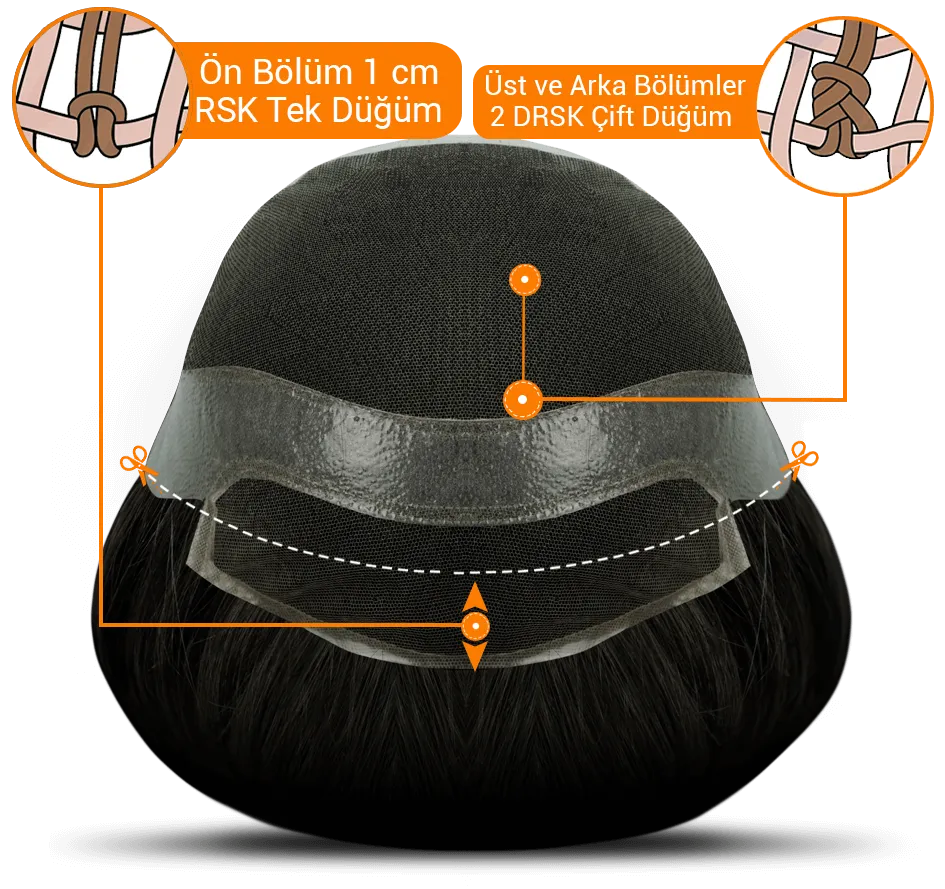 Tam kalıp protez saç