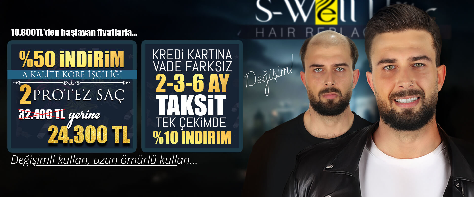 protez saç