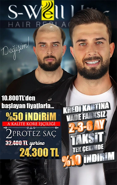 protez saç