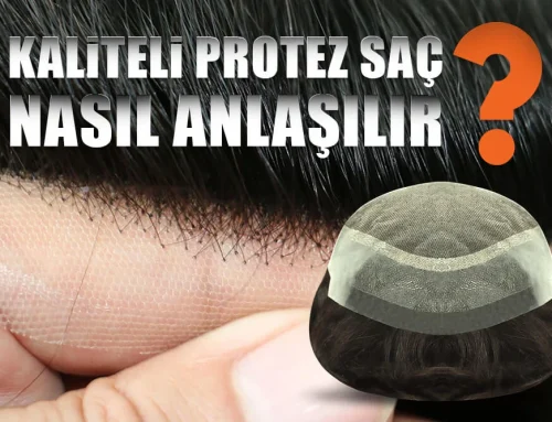 KALİTELİ PROTEZ SAÇI NASIL ANLARSINIZ?