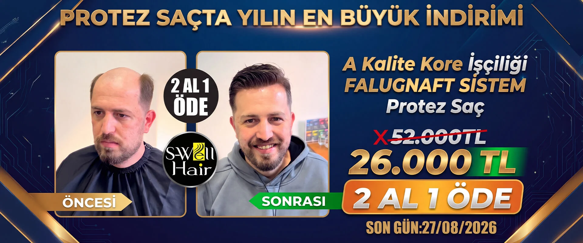 protez saç