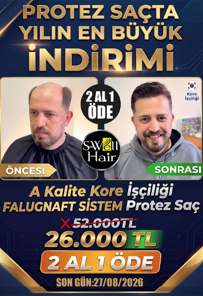 protez saç