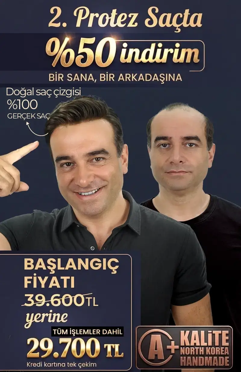 protez-sac protez saç