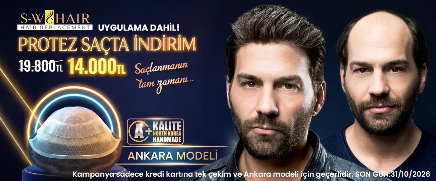Protez saçta indirim kampanyası - Ankara modeli 14.000 TL