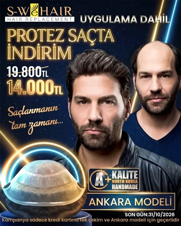 Protez saçta indirim kampanyası - Ankara modeli 14.000 TL